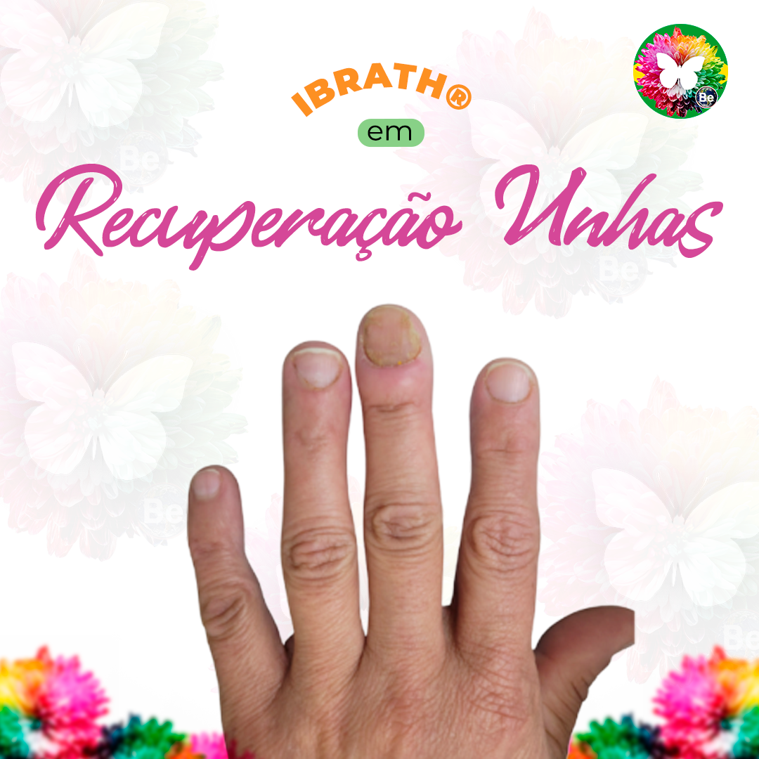 Curso De Unha Decorada